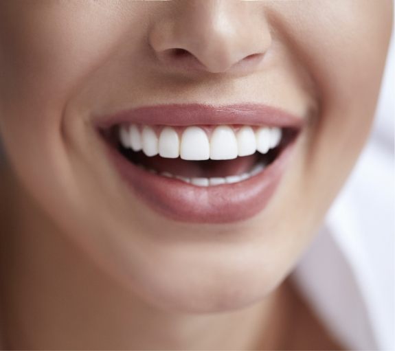 Close up of person with straight white teeth smiling