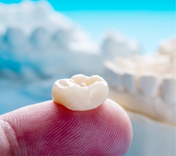 Dental crown resting on a finger